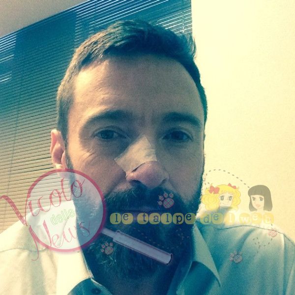 rs_600x600-140508162349-600-hugh-jackman-nose-instagram.ls.5814_copy